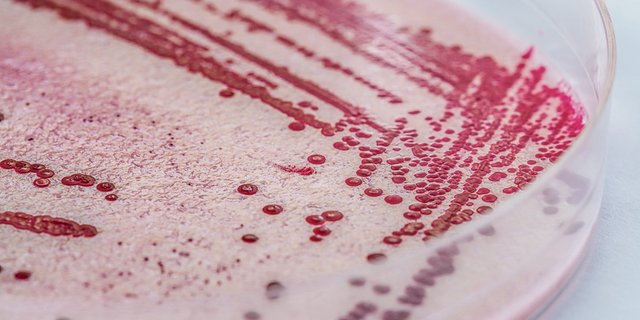 Um Listerien nachzuweisen, werden die Bakterien aus einer Probe kultiviert. Von Auge sehen oder riechen kann man eine Kontamination von Lebensmitteln mit Listerein nicht. (Bild Adobe Stock)