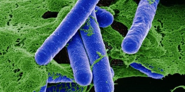 Clostridium botulinum kann akute Vergiftungen bei Tieren auslösen, die zum schnellen Tod führen. (Bild pa) 