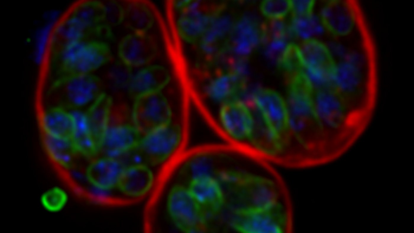 Drei Zysten wie sie im Gehirn von chronisch infizierten Tieren und dem Menschen vorkommen. (Bild UZH)