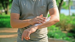 Kein Luxus, sondern wichtig für die Gesundheit: Bei Sonne das Verhalten anpassen, sich richtig kleiden und genügend eincremen.