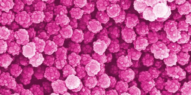 Auf dieser nachträglich eingefärbten Aufnahme eines Elektronenmikroskops sehen die Nanoplastik-Teilchen noch ganz schön aus. (Bild Empa / ETH)