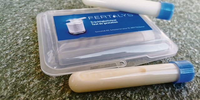 Wer Trächtigkeit, Zellzahl, Gehalte, Harnstoff oder Mastitiden in der Milch untersuchen will, muss selbst Proben nehmen.(Bild sb)