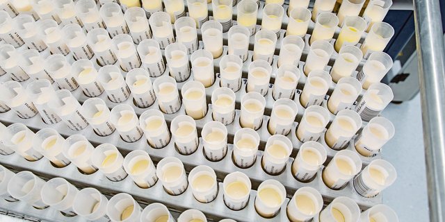 Analyse bei Suisselab: Der Modellwechsel der ZMP wirkt sich bislang positiv auf die Milchqualität aus.   (Archivbild hj)