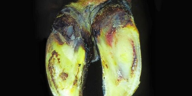 Rinderklaue mit Sohlenblutungen aufgrund einer Klauenreheerkrankung.